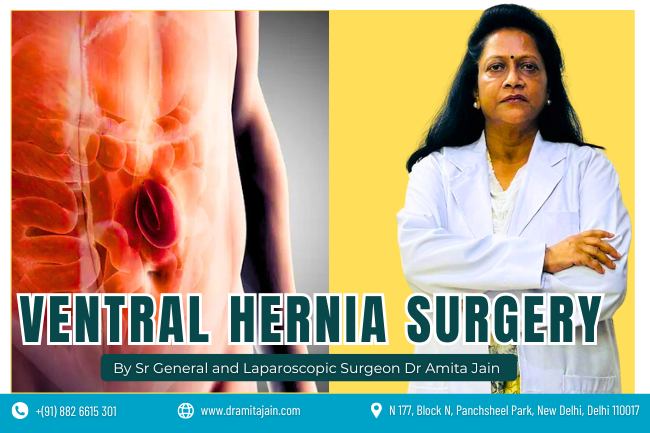Dr Amita Jain best surgeon for ventral hernia in Delhi and India